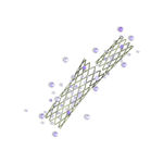 stent coronário