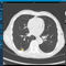 software de análiseVAREX Imaging