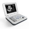 Aparelho De Ultrassom Portátil - XF30 - Xianfeng Ultrasound Medical ...