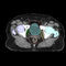 plataforma de IA médico-hospitalarVarian Oncology