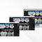 software de visualiza&ccedil;&atilde;oPearl's Second Opinion&reg;Carestream Dental