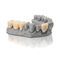 material dent&aacute;rio para impress&atilde;o 3DVarseoSmile&reg; TriniQ&reg;BEGO