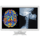 monitor cirúrgico / para endoscopia / de laparoscopia / Full HD