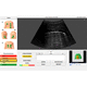 software médico-hospitalar / clínico / de análise / de monitorização