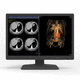 monitor médico / de diagnóstico / para radiologia / 30