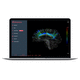 software para RM / para imagiologia cerebral / para IRM funcional / para neurocirurgia