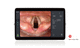 processador de vídeo para endoscopia / com monitor de vídeo / para imagens em Full HD