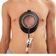 órtese de sucção para correção do pectus excavatum