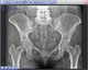 PACS com computação em nuvem / para exames de imagem