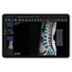 PACS para exames de imagem / baseado em tecnologia Web