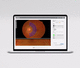módulo de software para oftalmologia / de medição / com inteligência artificial / de retina