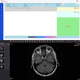 RIS baseado em tecnologia Web / de criação de laudos / visualizador DICOM / para exames de imagem