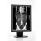 monitor de diagnóstico / para exames de imagem / 2048 x 1536 / 21,3