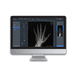 software de aquisição / de tratamento / para radiologia / Windows