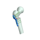 placa de osteotomia para fêmur / proximal / distal / bloqueada
