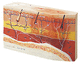 modelo anatômico de pele / de tratamento de úlceras